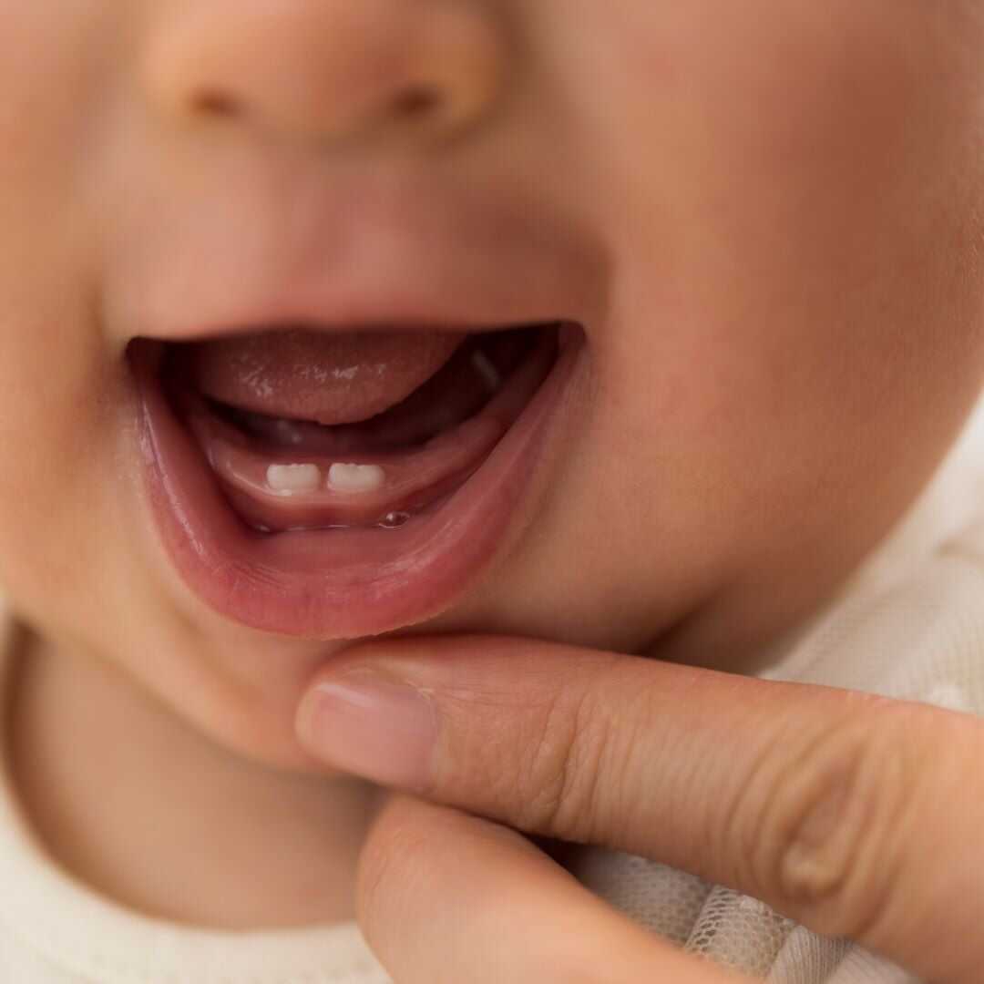 Baby teething - Conslusion
