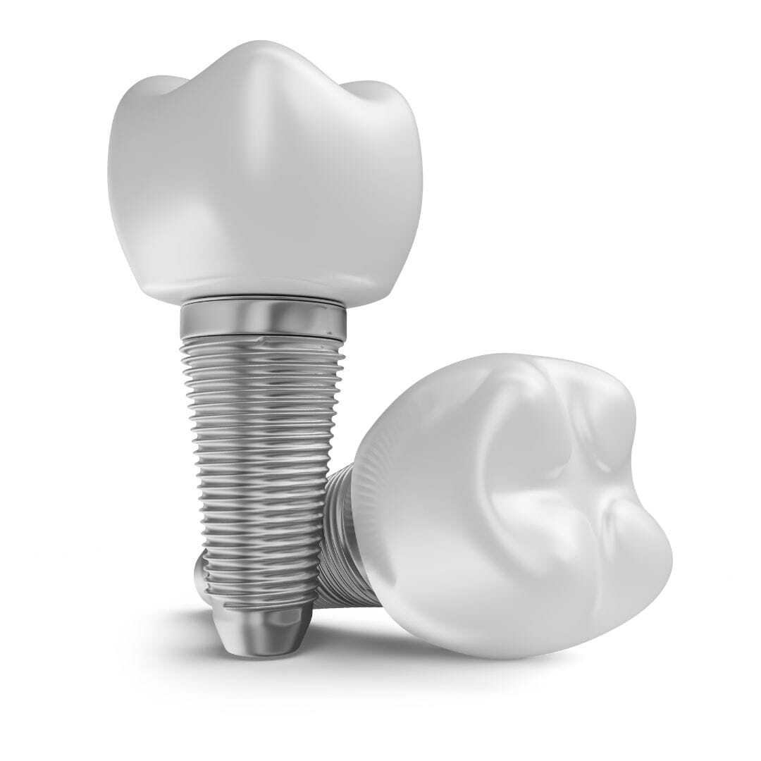 Choosing dental implants - Conclusion: Making an Informed Decision About Dental Implants in Gurgaon