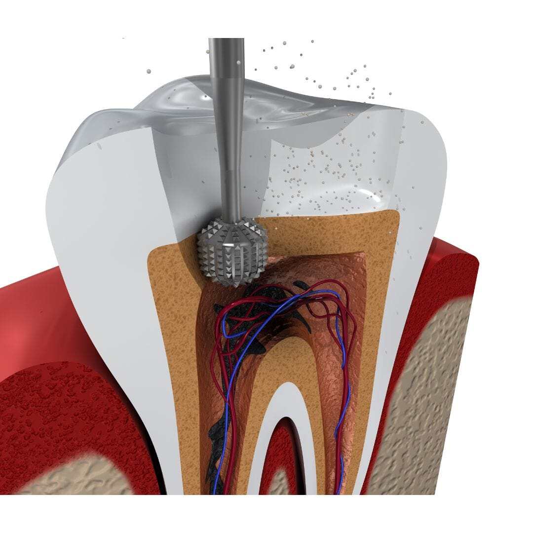 Dental trauma first aid - Expert Insights from Dr. Shipra Jain at Mahavirai Dental and Medical Care (2)