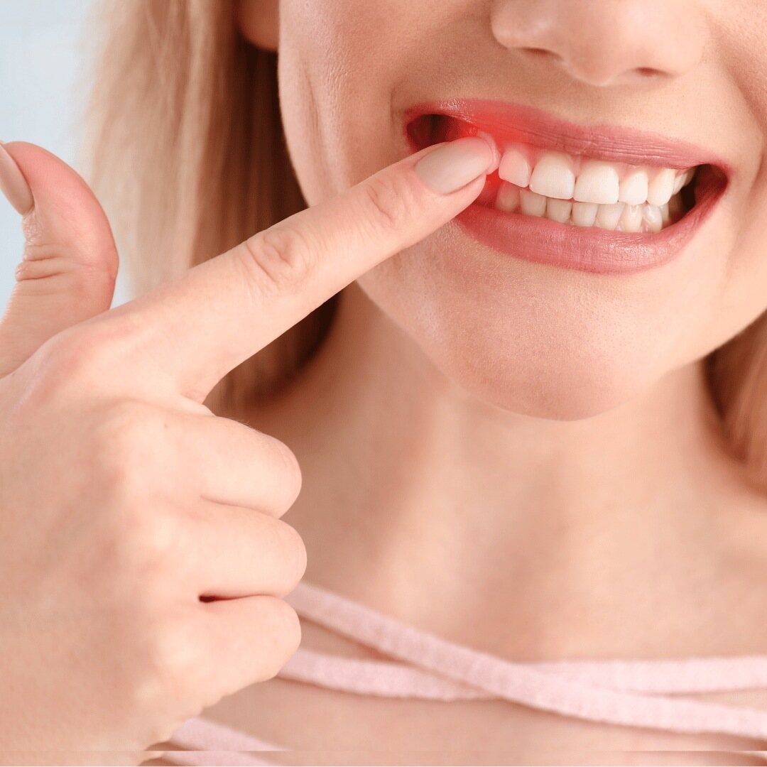 Gum disease and your health - Conclusion: Prioritize Your Oral Health