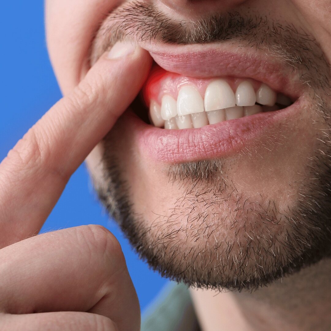 Gum disease and your health - Conclusion: Prioritize Your Oral Health (2)