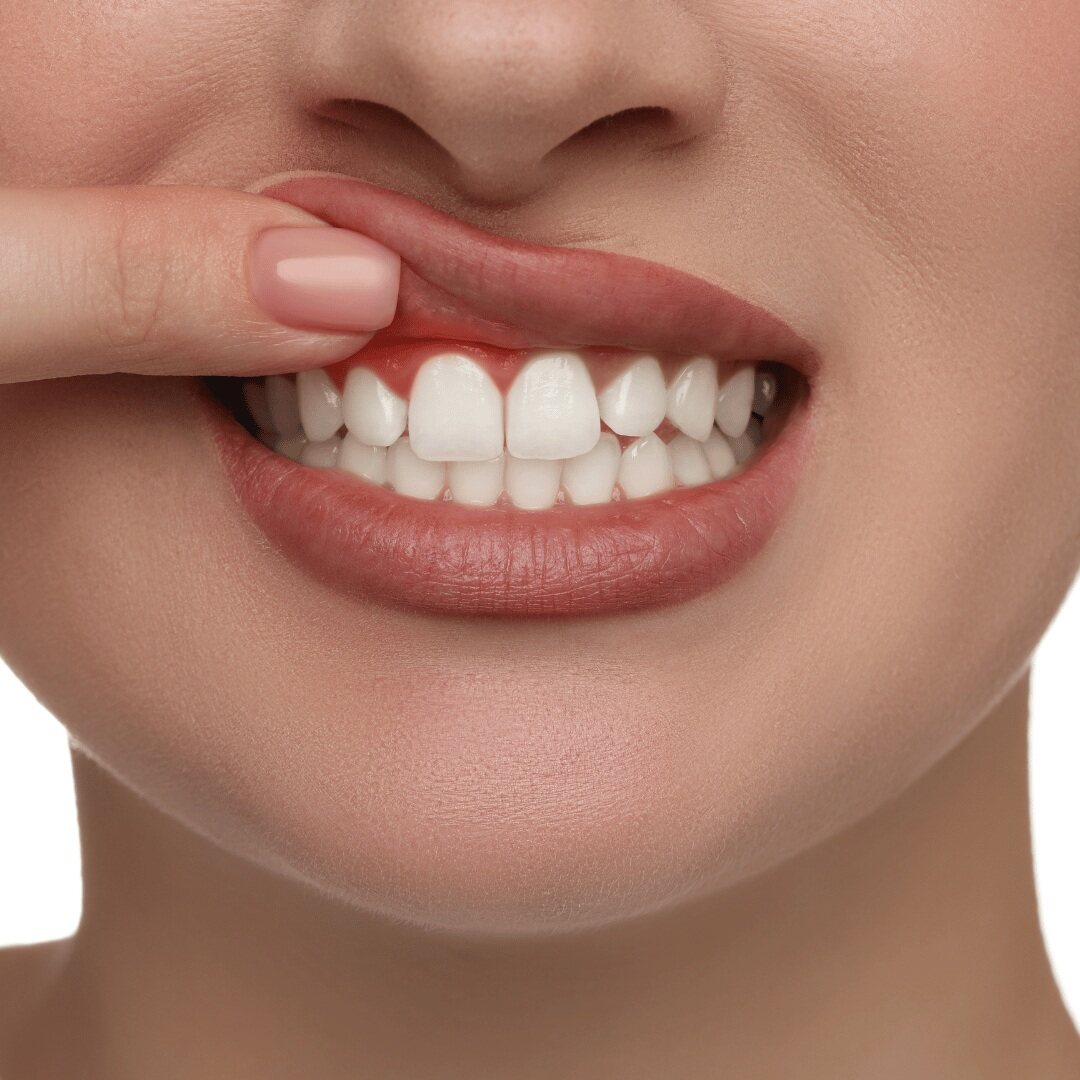 Gum disease and your health - Conclusion: Prioritize Your Oral Health (3)