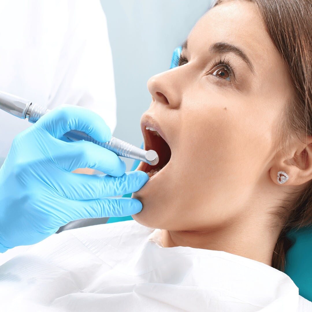 Root canal during pregnancy - Where to get Root Canal Treatment done during pregnancy? (5)