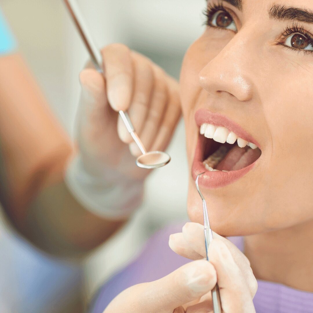 Teeth whitening guide - Maintaining a Bright Smile (2)