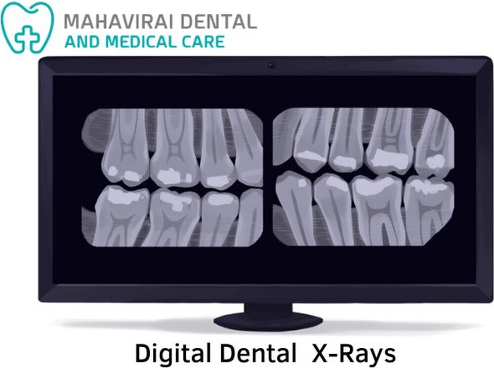 Digital dental X-rays displayed on a chairside monitor at Mahavirai Dental, Gurgaon